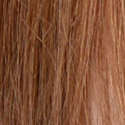 Df Exposure image 28