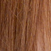 Df Exposure image 33