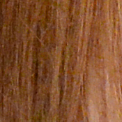Df Exposure image 36